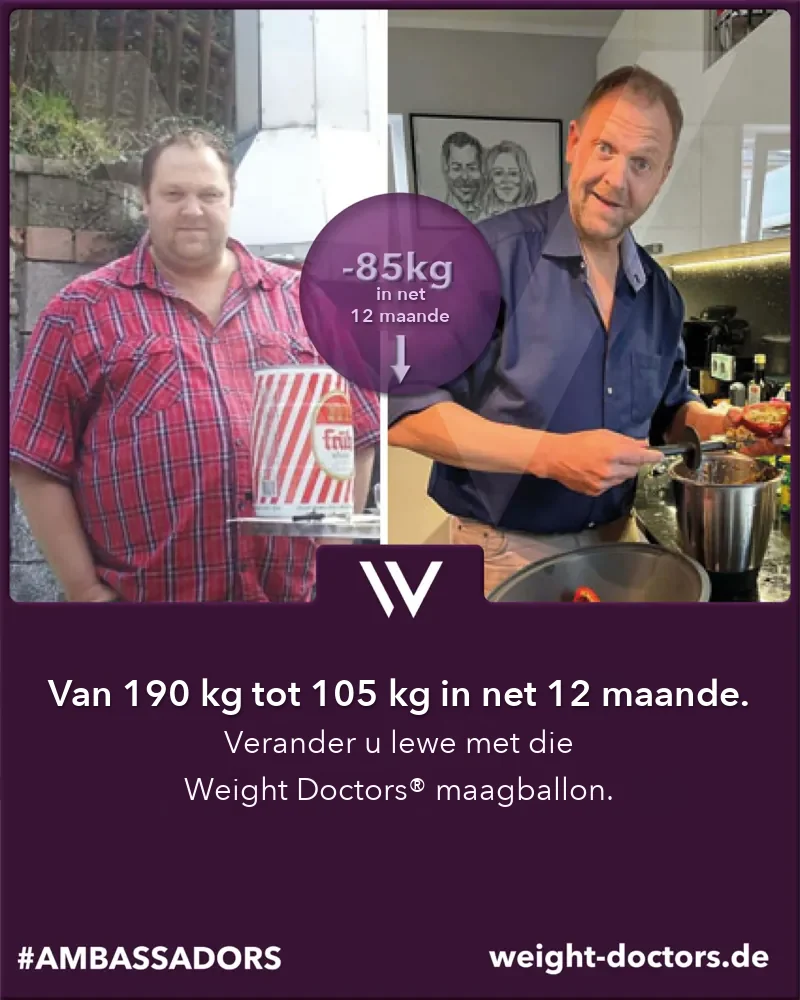 Weight Doctors® voor en ná: manlike pasiënt van 190 kg tot 105 kg in twaalf maande, met die Weight Doctors® MAAGBALLON