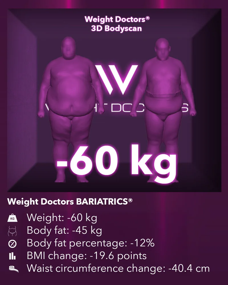 Weight Doctors® 3D Bodyscan before and after: minus 60 kg with Weight Doctors BARIATRICS®, body fat minus 45 kg