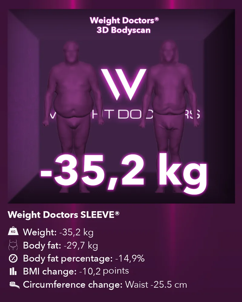 Weight Doctors® 3D Bodyscan before and after: minus 35.2 kg with Weight Doctors SLEEVE®, body fat minus 29.7 kg