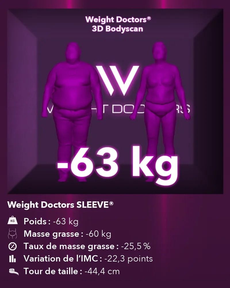 Weight Doctors® 3D Bodyscan avant et après&nbsp;: moins 63 kg avec Weight Doctors SLEEVE®, masse grasse moins 60 kg