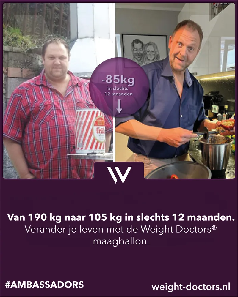 Weight Doctors® voor en na: patiënt van 190 kg naar 105 kg in twaalf maanden, met de Weight Doctors® MAAGBALLON
