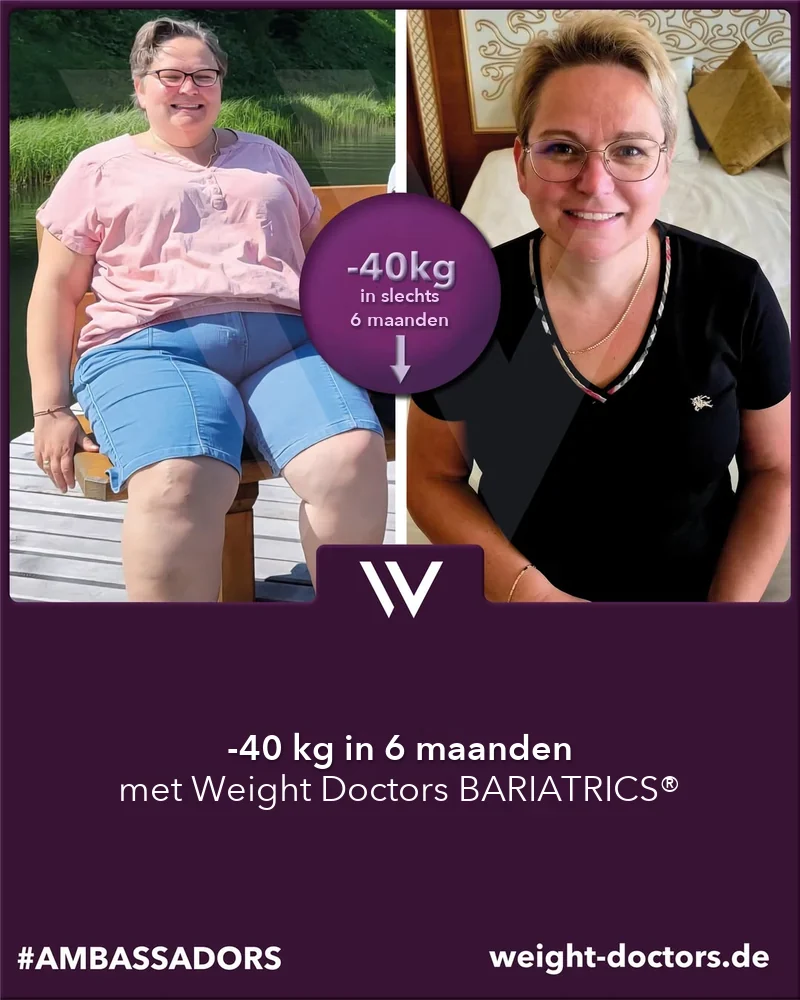 Weight Doctors® voor en na: patiënte met 40 kg minder in zes maanden, met Weight Doctors BARIATRICS®