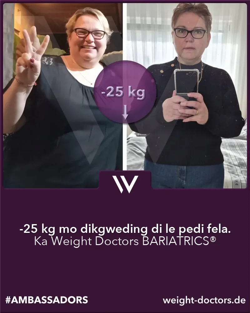 Weight Doctors® pele le morago: molwetse yo o fokoditseng 25 kg mo dikgweding di le pedi, ka Weight Doctors BARIATRICS®