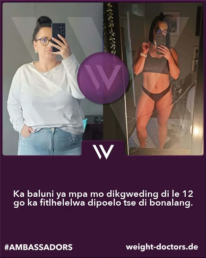 Weight Doctors® pele le morago: molwetse wa mosadi pele le morago ga dikgwedi tse lesome le bobedi ka Weight Doctors® BALUNI YA MPA
