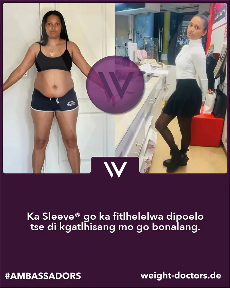 Weight Doctors® pele le morago: molwetse wa mosadi pele le morago ga Weight Doctors SLEEVE® ya gagwe