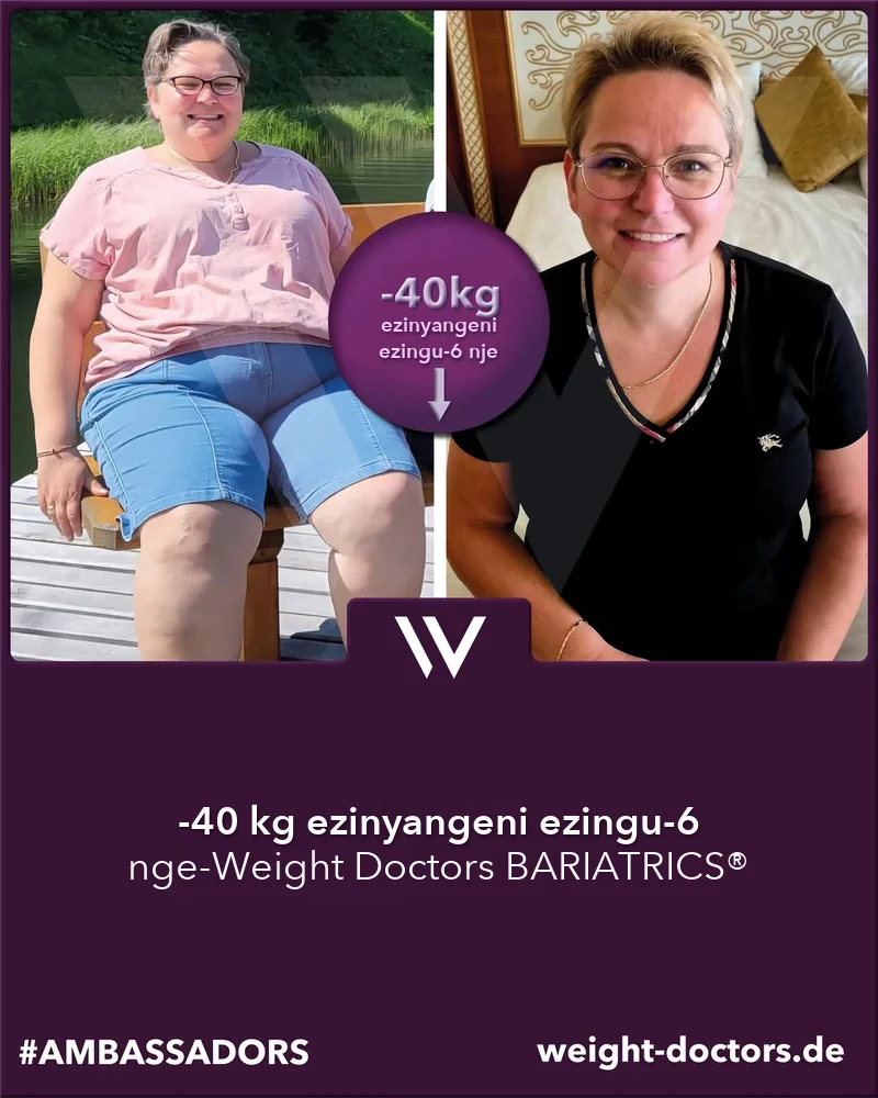 Ngaphambili nangemuva kwe-Weight Doctors®: isiguli sesifazane sehle ngo-40 kg ezinyangeni eziyisithupha, nge-Weight Doctors BARIATRICS®