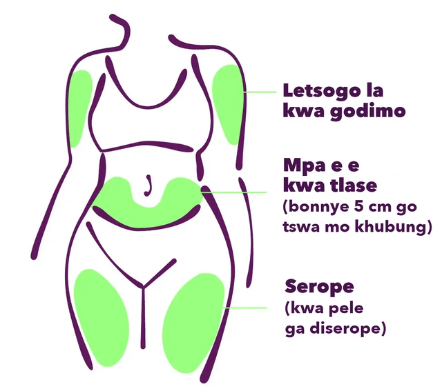 Mafelo a a ka tlhabiwang: letsogo la kwa godimo, mpa e e kwa tlase (bonnye 5 cm go tswa mo khubung) le kwa pele ga diserope